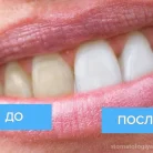 Моя стоматология Плюс на проспекте Энергетиков Фотография 6