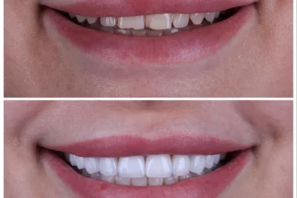 Стоматология West dental на Голландской улице Фотография 2