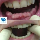 Стоматологическая клиника Белозубофф Фотография 8