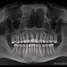 Стоматологическая клиника Белозубофф Фотография 3