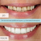 Клиника цифровой стоматологии и ортодонтии Чистое Дыхание на Будапештской улице Фотография 8