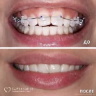 Стоматологическая клиника Super Smile на Фермском шоссе Фотография 11