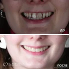 Стоматологическая клиника Super Smile на Фермском шоссе Фотография 18