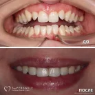 Стоматологическая клиника Super Smile на Социалистической улице Фотография 10