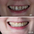 Стоматологическая клиника Super Smile на Социалистической улице Фотография 5