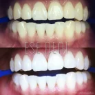 Стоматологическая клиника Есе дент Фотография 2