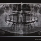 Стоматология Все свои! в Приморском районе Фотография 5