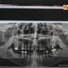 Стоматология Все свои! в Приморском районе Фотография 7