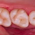 Стоматологический центр Elite dental club Фотография 4