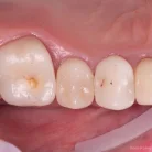 Стоматологический центр Elite dental club Фотография 6
