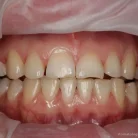 Стоматологический центр Elite dental club Фотография 5