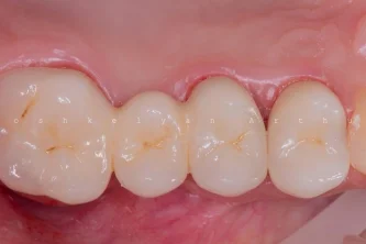 Стоматологический центр Elite dental club Фотография 2