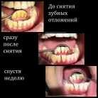 Стоматология Улыбка 32 Фотография 5
