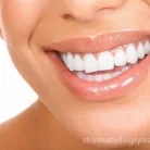 Клиника стоматологии и имплантации СтомЛайф Фотография 6
