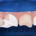 Стоматологическая клиника Smile dental clinic Фотография 8