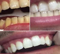 Стоматологическая клиника Smile design studio Фотография 2