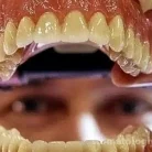 Клиника эстетической стоматологии ДентЭстетик на Коломенской улице Фотография 1
