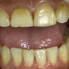 Стоматологическая клиника Крисмас Дентал Фотография 5