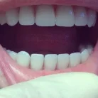 Стоматология Улыбка Фотография 8