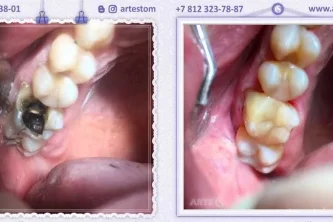 Стоматологическая клиника Arte-s Фотография 2