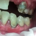 Стоматологический кабинет Юни Фотография 6