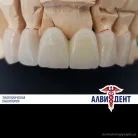 Зуботехническая лаборатория АЛВИДЕНТ Фотография 3