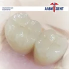Зуботехническая лаборатория АЛВИДЕНТ Фотография 1