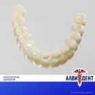Зуботехническая лаборатория АЛВИДЕНТ Фотография 4
